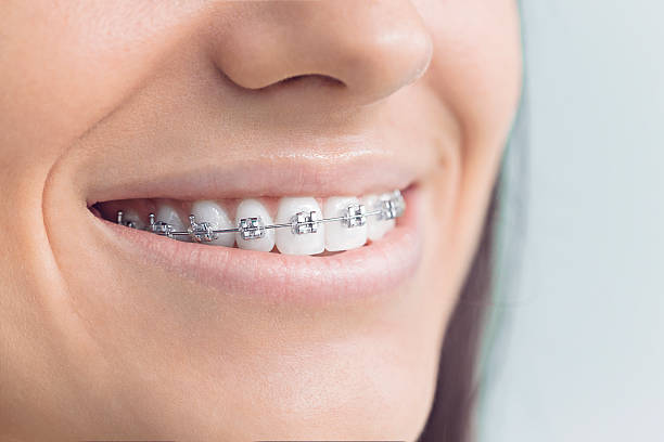 Best Invisalign and Clear Aligners  in Petersburg, IL